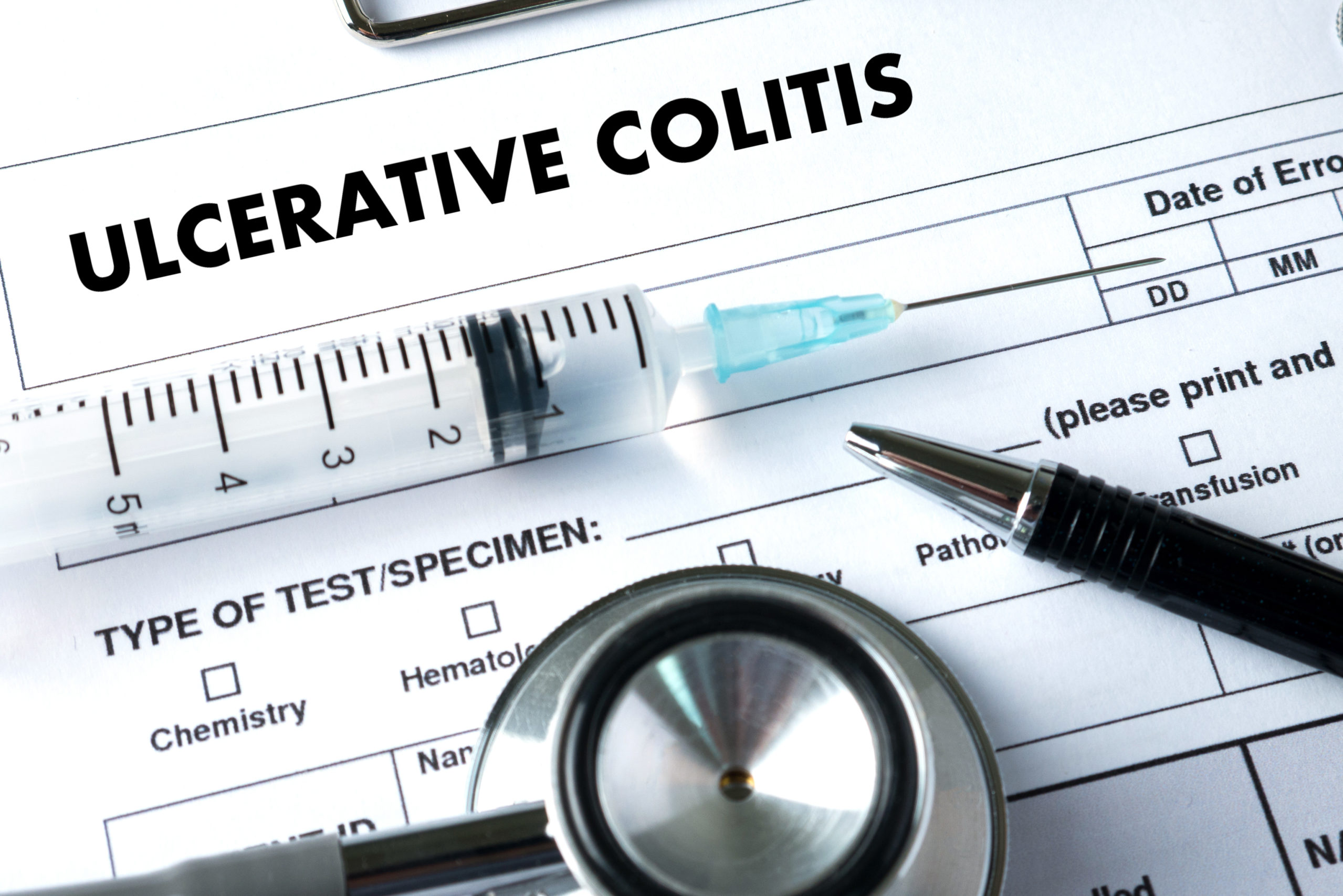 what is ulcerative colitis
